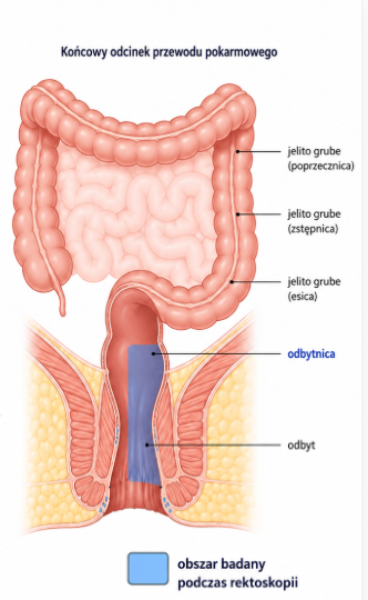 Schemat końcowego odcinka przewodu pokarmowego z zaznaczonym obszarem badanym podczas rektoskopii: jelito grube, odbytnica, odbyt